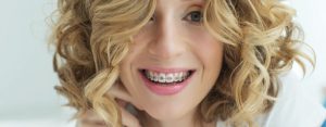 Adult woman with braces smiling