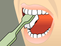 Model of how to brush your lower-left teeth