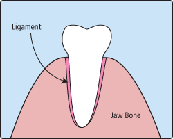 Infographic showing how a tooth is extracted